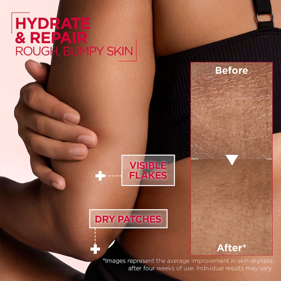 Mixa Body Cream Urea Cica Repair+ 400mL