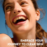 Nivea Facial Gel Derma Skin Clear - 150mL