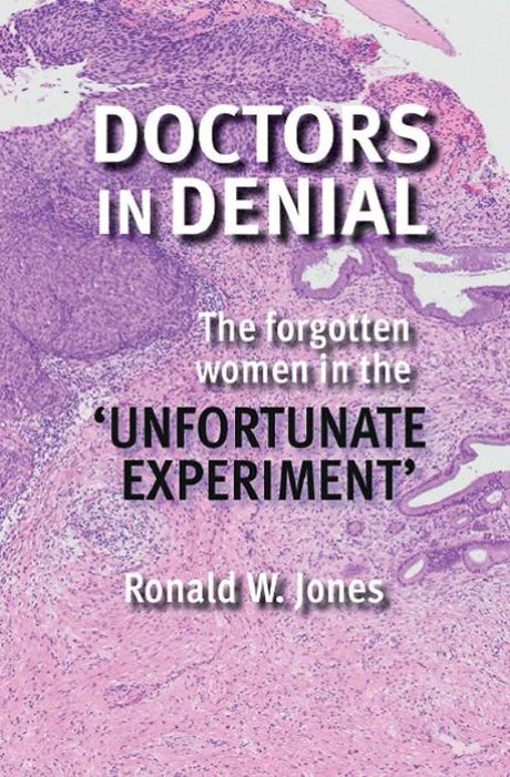 Book cover of 'Doctors in Denial' by Ronald Jones, revealing medical ethics issues in an unethical study on cervical cancer.